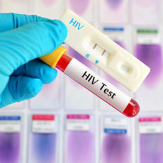 HIV diagnoses at Amida Care in NYC